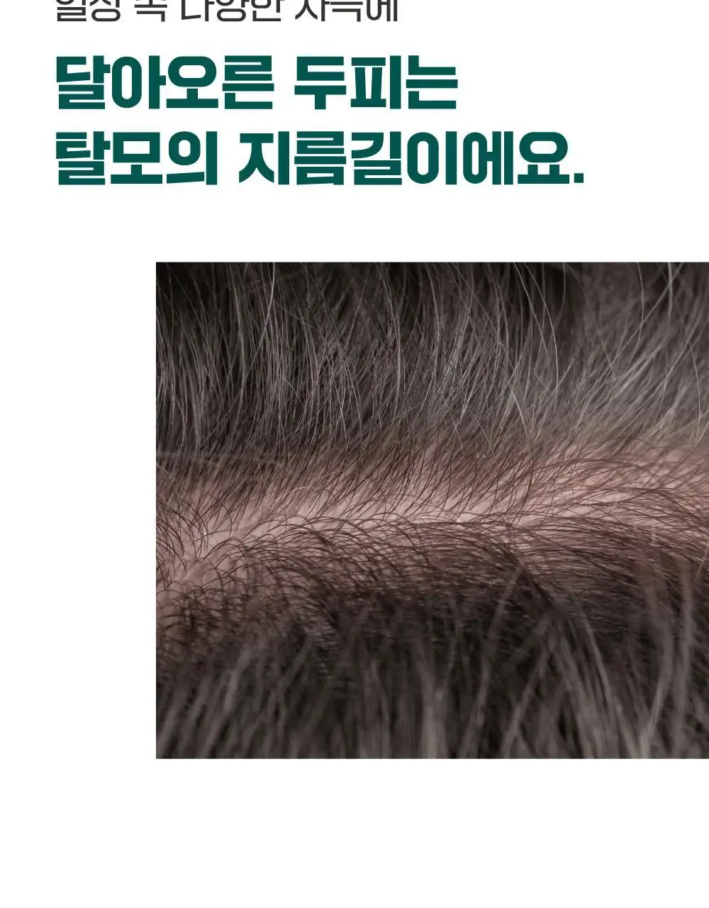 [소취케어] 라운드랩 소나무 진정 시카 두피 토닉 100ml 기획(+샴푸 50ml) 상세페이지 12